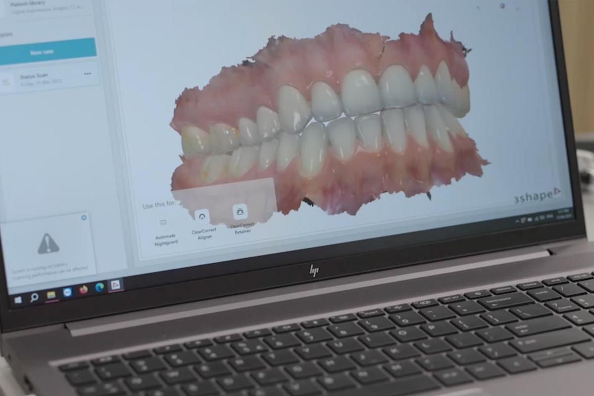 scan of patients teeth