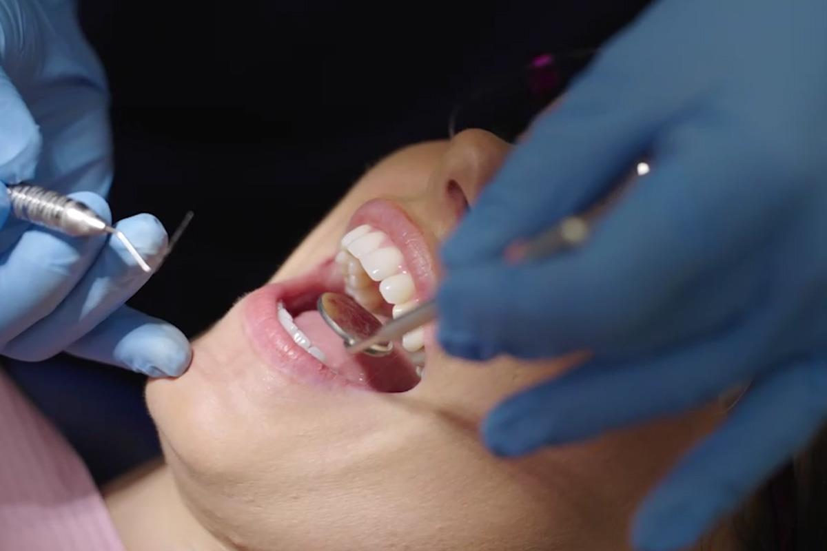 womans teeth